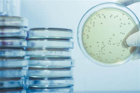 What Is A Legionella Testing Kit? | Legionella Testing | uRisk