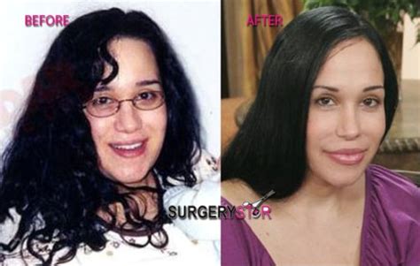 Nadya Suleman 'Octomom' Before And After Plastic Surgery