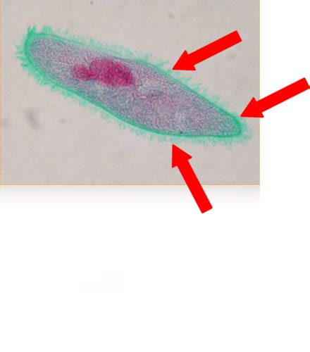 Phylum Ciliophora Flashcards | Quizlet