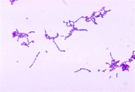 Streptococcus - JungleKey.fr Image