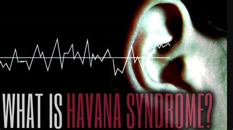 Symptoms of the "Havana syndrome"