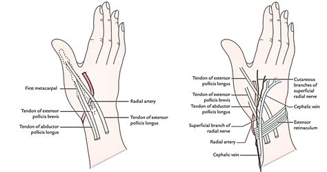 Easy Notes On 【Anatomical Snuffbox】Learn in Just 3 Minutes!