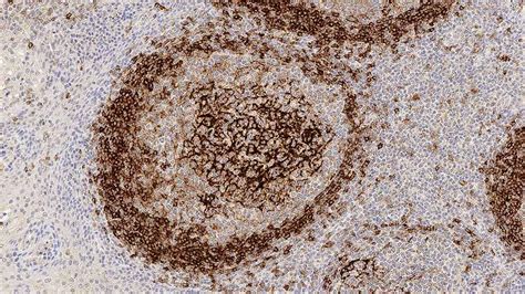 CD23 - IHC Primary Antibodies