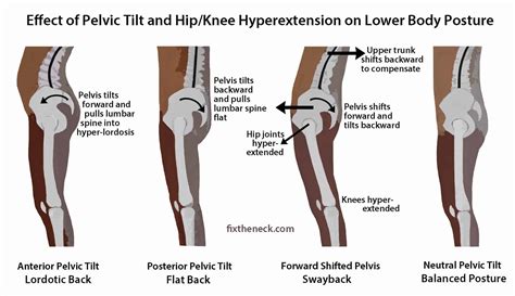 Posterior Pelvic Tilting – Even Simpler – POST COMPETITIVE INSIGHT