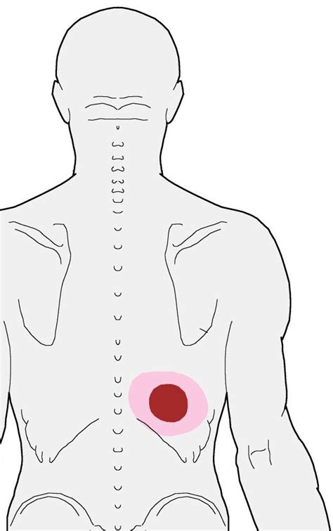 Trigger Points Back Pain - tbko1