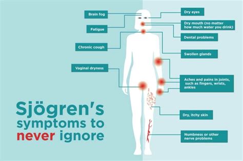 Sjögren’s Syndrome Symptoms You Might Be Ignoring | Sjogrens syndrome ...