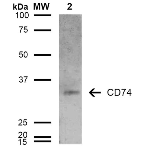 Anti-CD74 / CLIP Antibody | Mouse anti-Human Monoclonal RPE IF,WB | LSBio