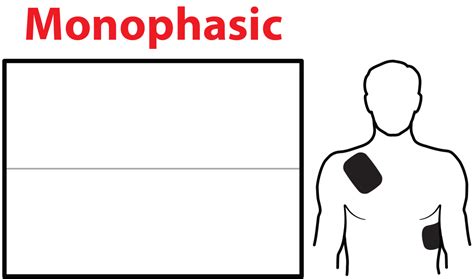 Monophasic vs Biphasic Waveform Defibrillation