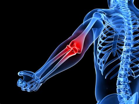 Common Causes of Elbow Pain - Blessed Physical Therapy, Pain Relief ...