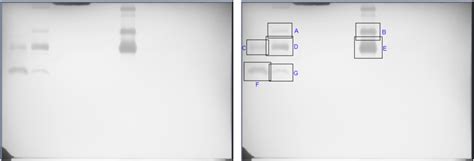 Zymography 4 and the masks de¯nition with labels. | Download Scientific ...