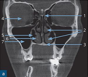 Dentoalveolar Anatomy | Pocket Dentistry