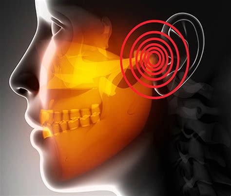 TMJ : Prevention & Cure of Jaw Joint Problems | Directorio Odontológico