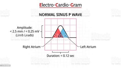 P Wave Ecg Sinus Normal Electrocardiogram Morphology P Wave Stock ...