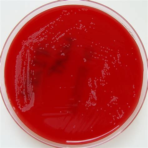 Moraxella catarrhalis on Columbia Horse Blood Agar - a photo on Flickriver