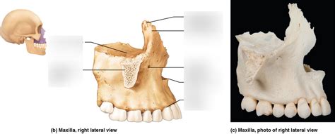 Maxilla Bone Markings Diagram | Quizlet