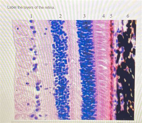 Solved Label the layers of the retina. 1 2 3 4 5 6 | Chegg.com