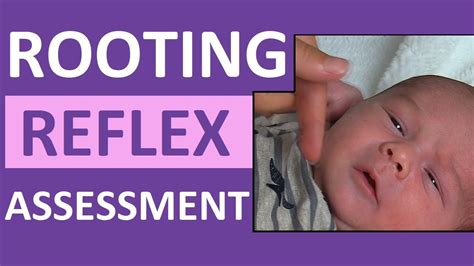 Rooting Reflex in Newborn Infant Baby | Pediatric Nursing Assessment ...