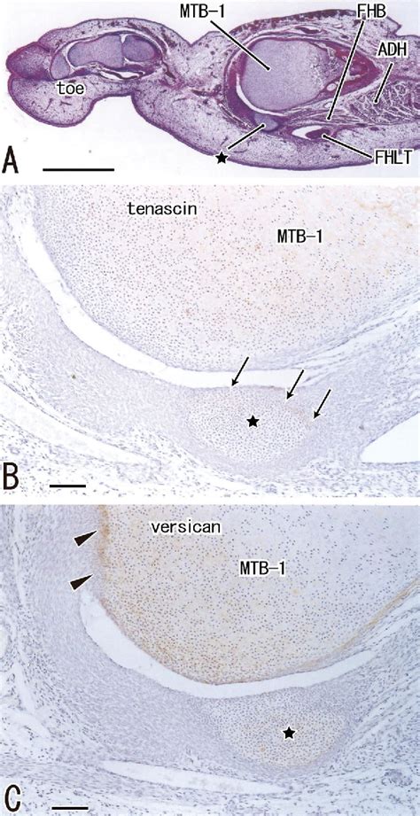 Figure 3 from A new insight into the fabella at knee: the foetal ...