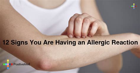 12 Signs You Are Having an Allergic Reaction - PositiveMed