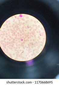 Plasmodium Vivax Light Microscope Stock Photo 1170668695 | Shutterstock