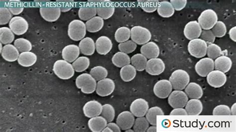 What Is a Staph Infection? - Causes, Symptoms & Treatments - Video ...