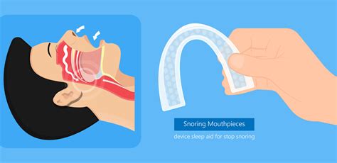 Mouth Guard for Snoring: A Complete Guide