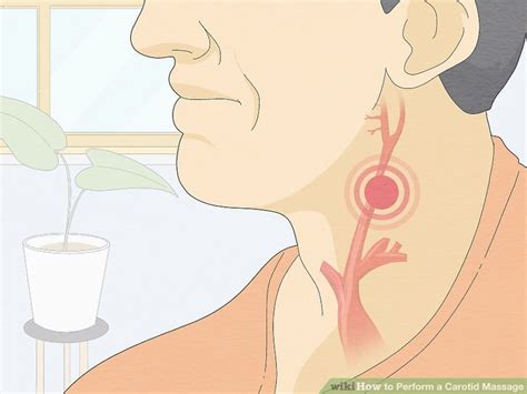 How to Perform a Carotid Massage: 12 Steps (with Pictures)