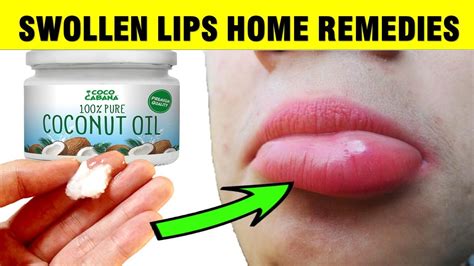 How To Treat SWOLLEN LIPS Naturally At Home - YouTube