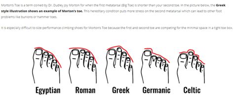 Roman Toes - Also, just googled, roman toe lists morton's toe as the #1 hit, however there are ...