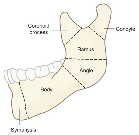 Mandible Fractures | Plastic Surgery Key