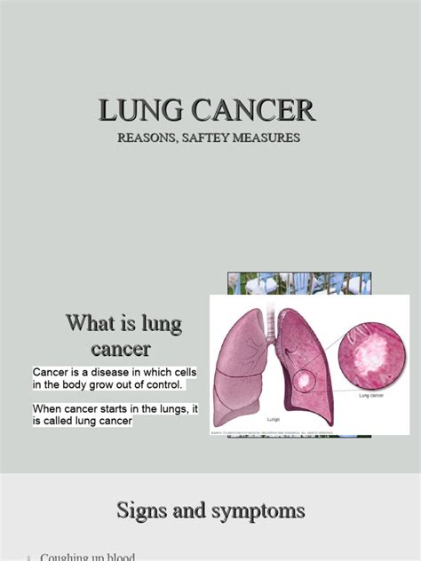 Lung Cancer | PDF