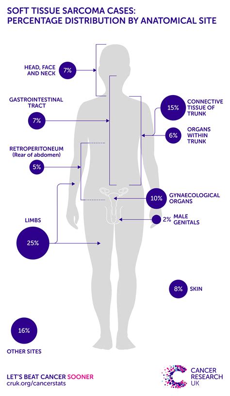 Malignant Pleural Mesothelioma