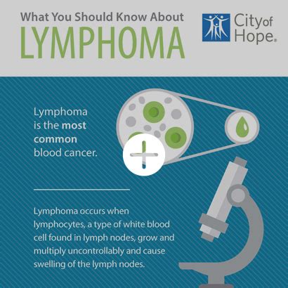 What Are the Hodgkin Lymphoma Symptoms and Signs?