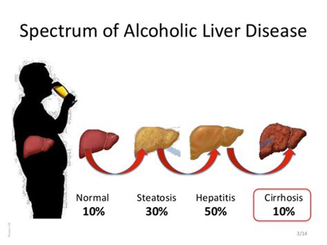 Ayur Liver Clinic, India.