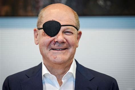 German Chancellor Olaf Scholz black eye patch