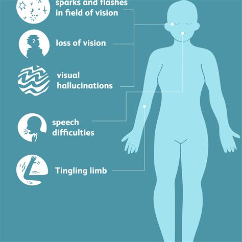 Migraine With Aura Symptoms Causes And Treatment – NBKomputer