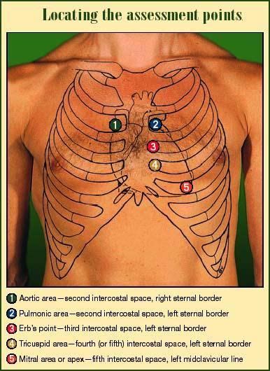 ape 2 man heart sounds | Medical assistant student, Nursing mnemonics ...