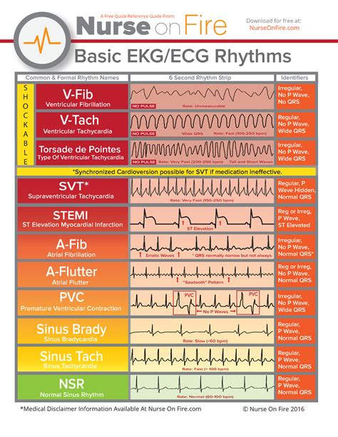 Basic EKG ECG Rhythms Cheatsheet - Basic EKG/ECG Rhythms V-Fib V-Tach ...