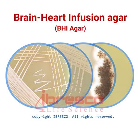 Brain Heart Infusion (BHI) Agar | ایبرسکو