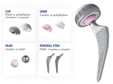 What is my Hip or Knee Replacement Made of? - Dr. Chien-Wen Liew