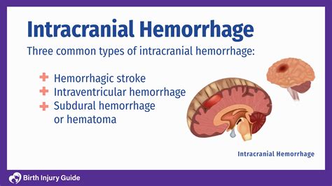 Intracranial Hemorrhage in Babies | Birth Injury Guide