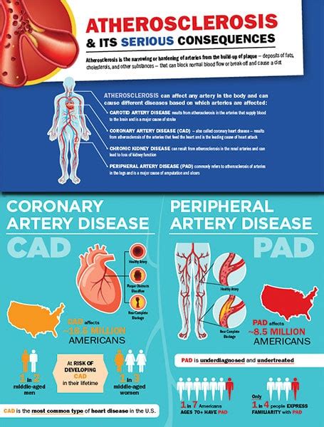 Atherosclerosis and Its Serious Consequences - Alliance for Aging Research