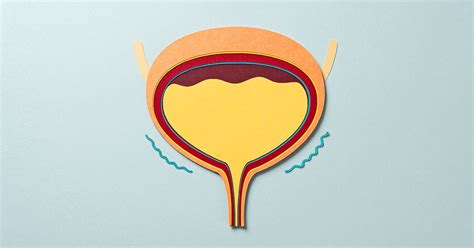 Underactive Bladder: Causes, Symptoms, Diagnosis, and Treatment