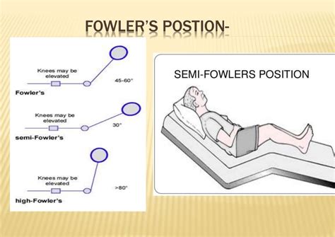 Patient position and anesthesia