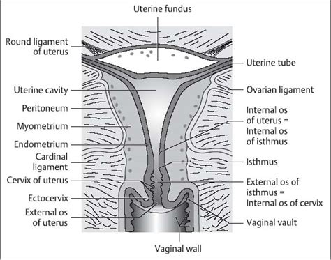 [DIAGRAM] Iud Cervix Diagram - MYDIAGRAM.ONLINE