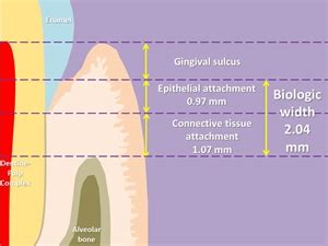 What is biological width in dentistry? | News | Dentagama