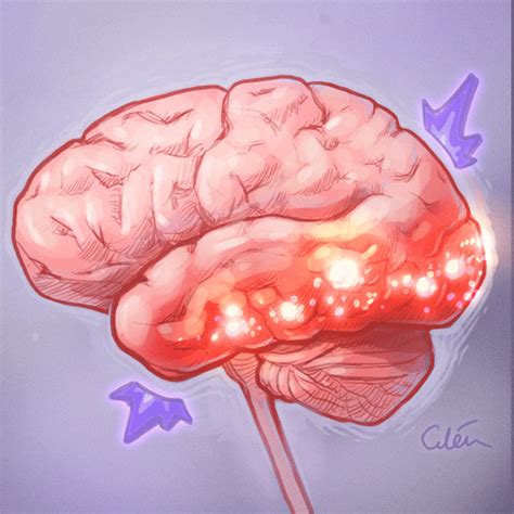 Anti-NMDA receptor encephalitis — artibiotics