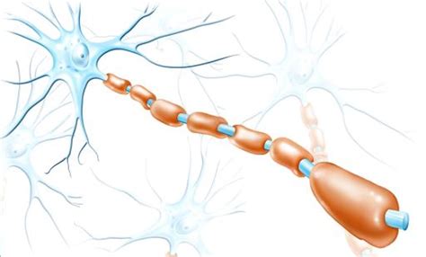 Teriflunomide Successfully Reduces Relapses and is Well Tolerated in Multiple Sclerosis Patients