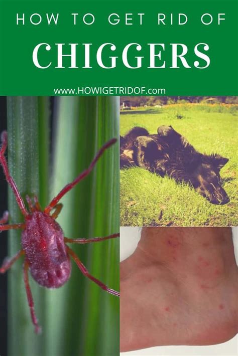 How To Get Rid of Chiggers - How I Get Rid Of