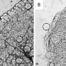 oocysts of Plasmodium vivax recovering from the midgut of (A) Anopheles ...